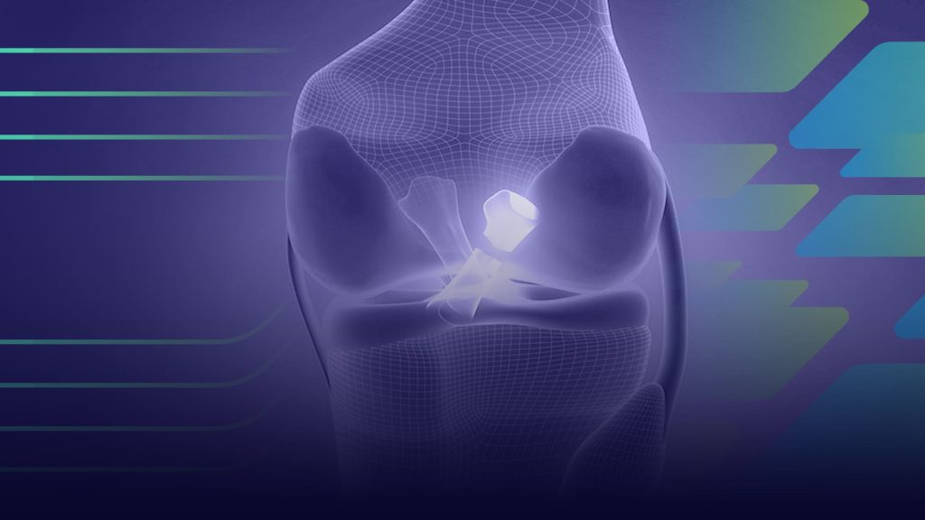 Ligamento cruzado posterior (LCP)