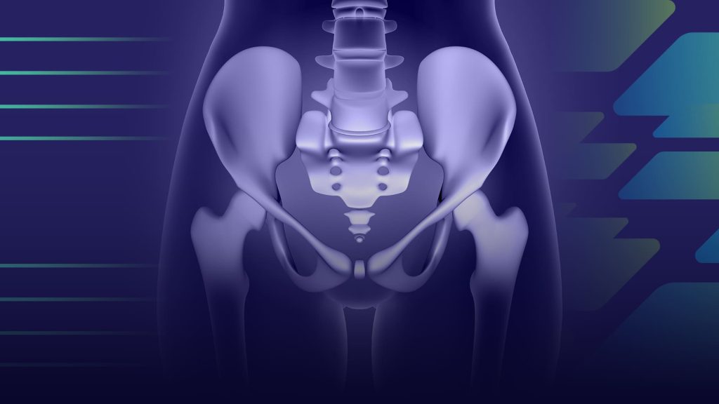 Osteoartrite de Quadril