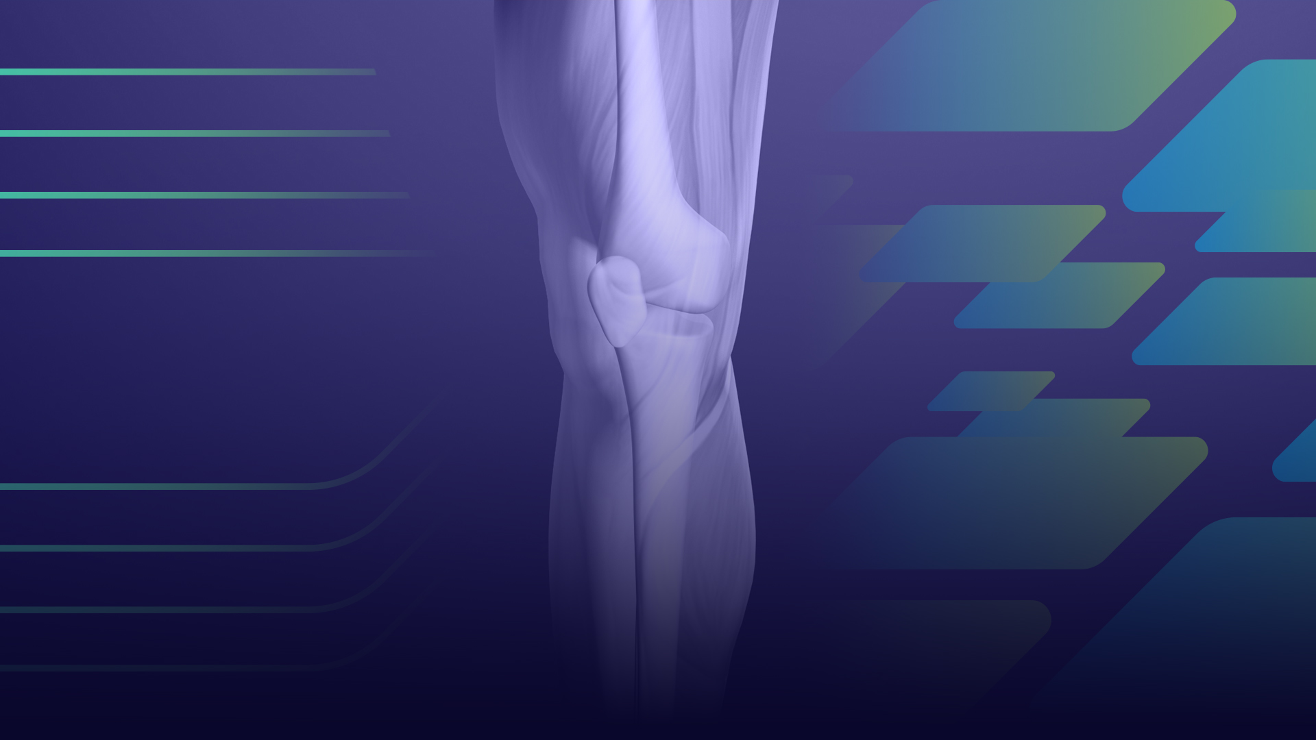 Artroplastia total de joelho