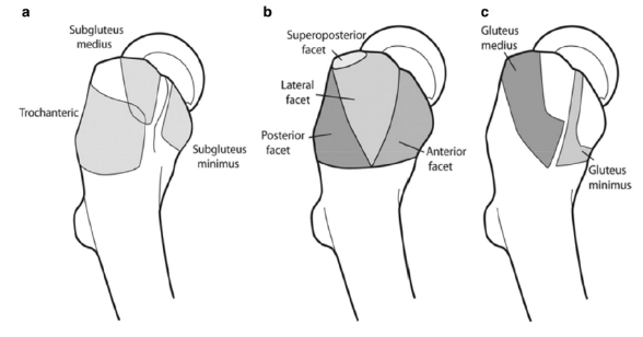 Síndrome da dor do trocânter maior Imagem 1. Anatomia do trocânter maior. a) Três principais bursas ao redor do trocânter maior; b) Faces do trocânter maior; c) Locais de inserção dos tendões dos músculos glúteo médio e mínimo. Fonte: Kumar et al., 2021.