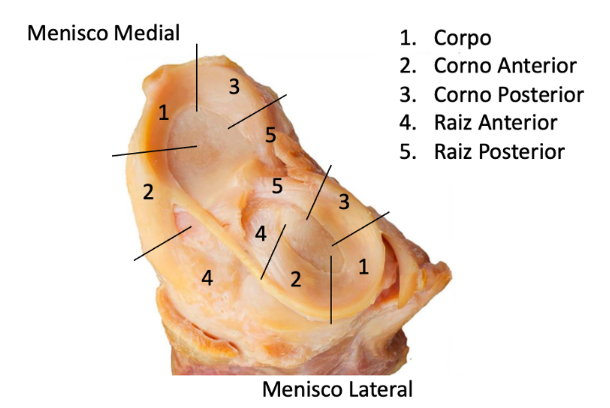 Figura 2. Divisões anatômicas do menisco medial e lateral. Fonte: Autoria própria.