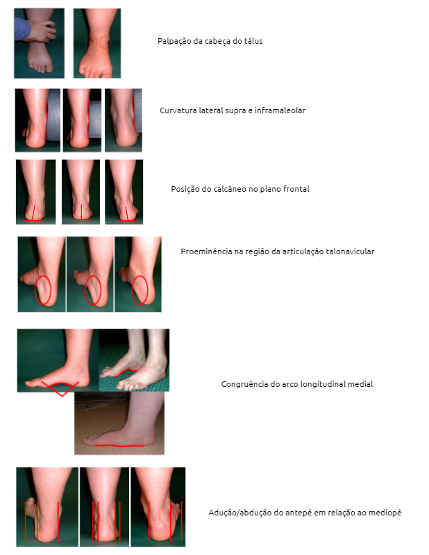 Figura 7: Os 6 itens que compõem o FPI-6. Fonte: Martinez BR, De Oliveira JC, Vieira KVSG & Yi LC (2019): Translation, Cross-cultural Adaptation and Reliability of The Foot Posture Index (FPI-6) - Brazilian Version, Physiotherapy Theory and Practice.
