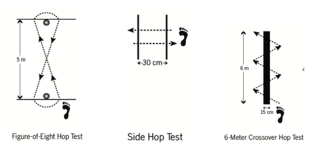 Figura 11: Hop Tests - Testes funcionais em diferentes direções. Leva-se em consideração o tempo que o paciente executa o teste escolhido e compara-se o mesmo teste após algumas semanas de tratamento. Fonte: Caffrey E et al, 2009.