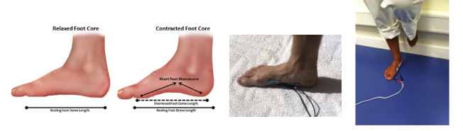 Figura 17: Fortalecimento da musculatura intrínseca do pé com o exercício Doming, também conhecido como short-foot exercise. Pode ser associado à eletroestimulação neuromuscular. Fonte: McKeon PO et al, 2015.