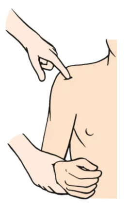 Figura 2. Teste da palpação do sulco bicipital. Fonte: Musculoskeletal Key - The Biceps Tendon. Disponível em: https://musculoskeletalkey.com/the-biceps-tendon-3/